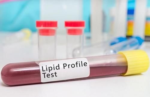 高血脂|甘油三酯偏高就是高血脂了？提醒：若未超过这个数，或无需担心