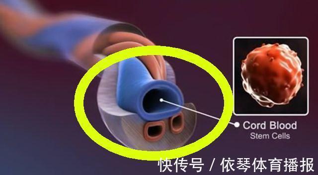 胎动|孕妈这个动作看似挺有爱,往往会致胎儿脐带绕颈,新手妈妈易犯错