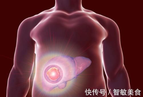 黄褐斑|大病降临前,通常会有6个前兆,早知早预防,或许可以逃过一劫!