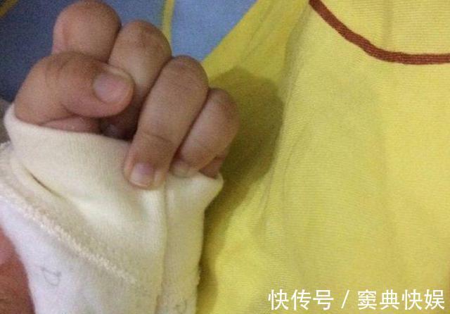 胎动|6个月婴儿紧握拳头，奶奶发现不对劲带去医院检查，医生来晚了