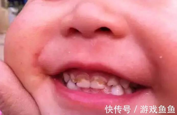 宁宁|宝宝半岁后迟迟不戒“夜奶”,可能会出现不良特征,家长需注意