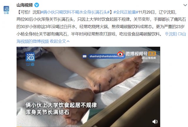 高尿酸血症|可怕！男子全身布满＂石头＂，只因喜欢…这些习惯很多人都有