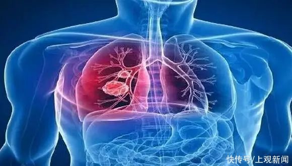 定时炸弹|「双语」人体内的＂定时炸弹＂