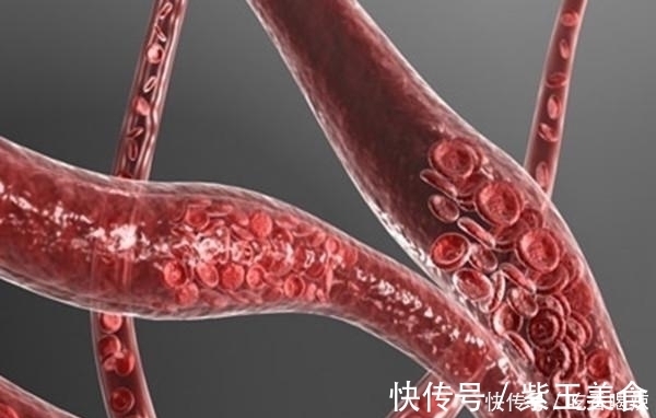 心肌缺血|不起眼的它,却是天然血管“清道夫”,每天吃一点,血栓不来扰!