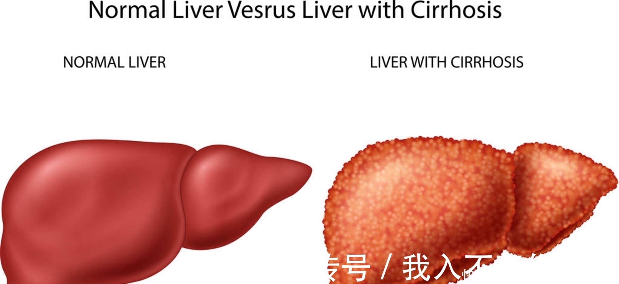 泡水|陈皮和它“天生一对”，泡水喝点，健脾养肝，血管干净不堵塞