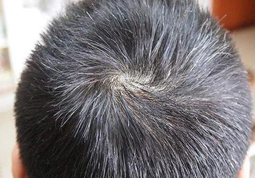 高寿|男人若出现这4个表现,寿命通常都是比较长的,高寿老人们全都拥有!