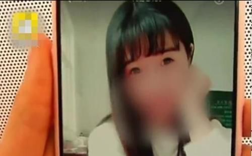 女子想做双眼皮，整形过后眼睑缺了一块，医院：不算整形失败