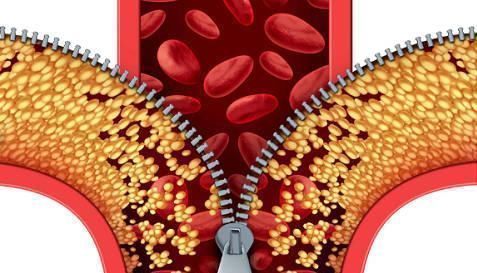 堵塞|中医直言血管一堵，易生百病，常吃5种蔬菜血管不再堵，别错过