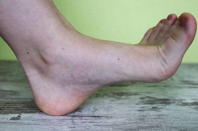 血栓|体内有血栓,身体会出现3个表现,学会一个动作,或能帮你化解