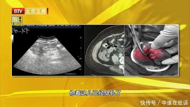 气血|大枣这样吃,功效翻几倍每天吃3颗,气血足,脾胃好