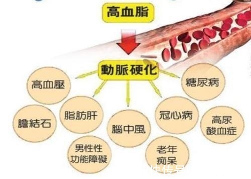 甘油三酯升高|高血脂不能吃什么 日常饮食高血脂不能吃什么