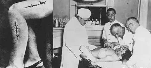 臭名昭著|历史上臭名昭著的实验德国纳粹对犹太人进行惨无人道的实验