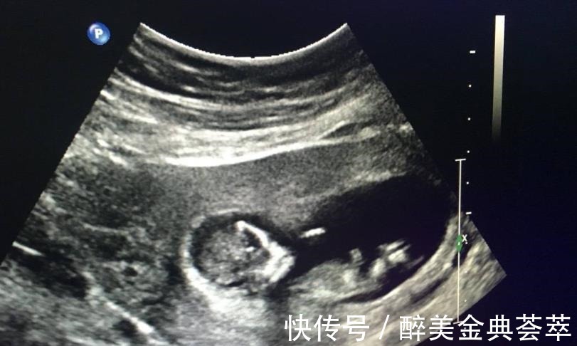 胃口|怀孕后,想知道胎儿性别是什么,可以尝试这些方法来鉴别