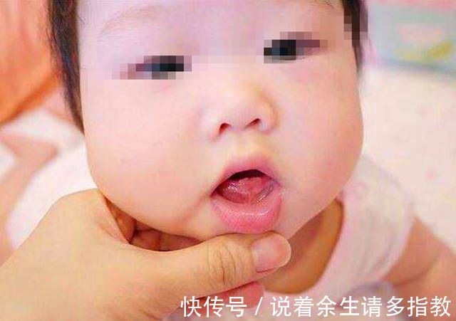 宝宝|2岁儿子总学“金鱼嘴”,全家都说好玩,奶奶一掰开嘴直奔医院