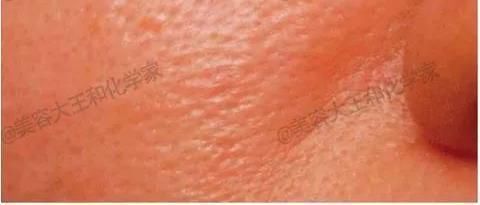 皮肤|你的日常=最强衰老预警难怪你没有姐姐们的逆天状态