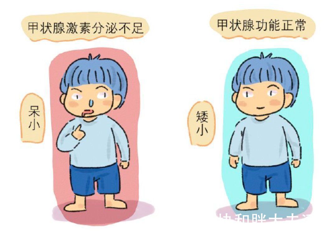 患儿|辟谣：矮小症会影响智力吗？