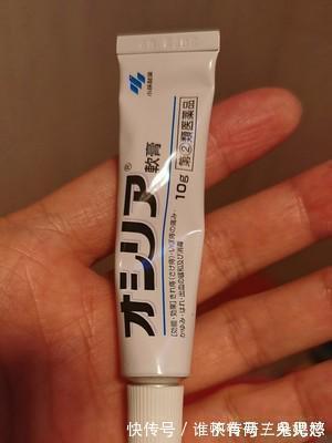 肛周|才知道痔疮缓解这么简单,痔疮用什么药膏擦着效果好?