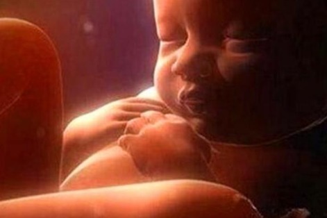 孕妈|原来孕妈做的一些事,可都是会影响胎儿的“颜值”的“天敌”