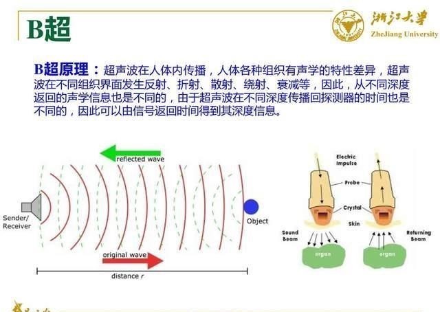 声波|做B超前涂的那层黏黏的、凉凉的液体是什么?做完要马上洗掉吗?