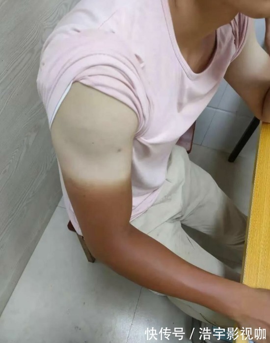 马路天使|男子晒“渐变色”皮肤,网友不服,一场“比惨”大赛开始了