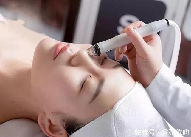 水杨酸|闭口、黑头、痘痘、脂肪粒……终于分清它们是什么了