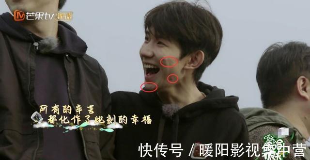 节目组|节目组失误关掉滤镜,王源满脸痘颜值大跌,杨超越皮肤不如董力!