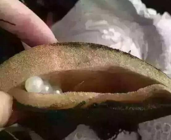 发痒|女孩身上发痒找不到原因，求助医生找不到问题，一把剪刀找到真相