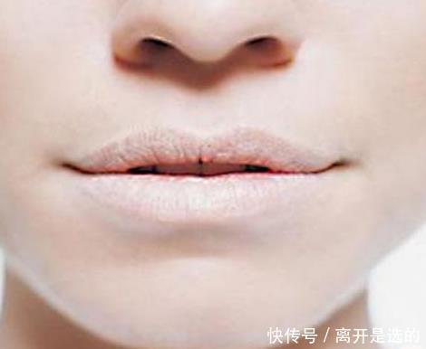 现象|肝不好的人,脸上八成有4种现象,若没有,说明肝脏保养得不错