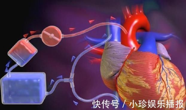 高血糖|高血脂人群,牢记:常吃1物,稳定血脂清理血管,赶走健康隐患!