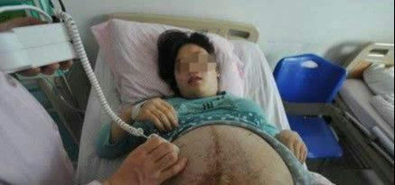 肚子|四胞胎孕妈38周还不生,婆婆含泪阻止手术,医生剖开肚子吓晕了