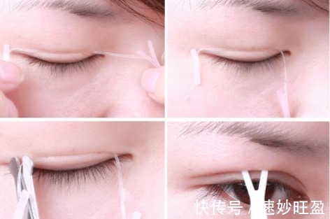 双眼皮|长期贴双眼皮贴的女生,后来怎么样了?教你一招避免眼皮松弛