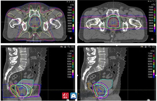 病区|万杰医院：贴心服务暖人心32次前列腺癌精准质子治疗获好评