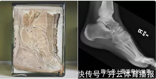 鹦鹉螺&这些东西内部长啥样?25张照片揭示日常事物看不见的一面!