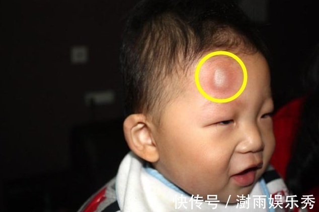 坠床|12个月大的宝宝不慎坠床,奶奶下意识的做法,却让孩子伤的更重