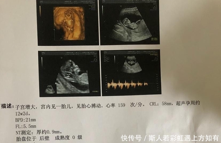 孕妇|确定怀孕后，第一次产检是在什么时候？超过这个时间，就晚了