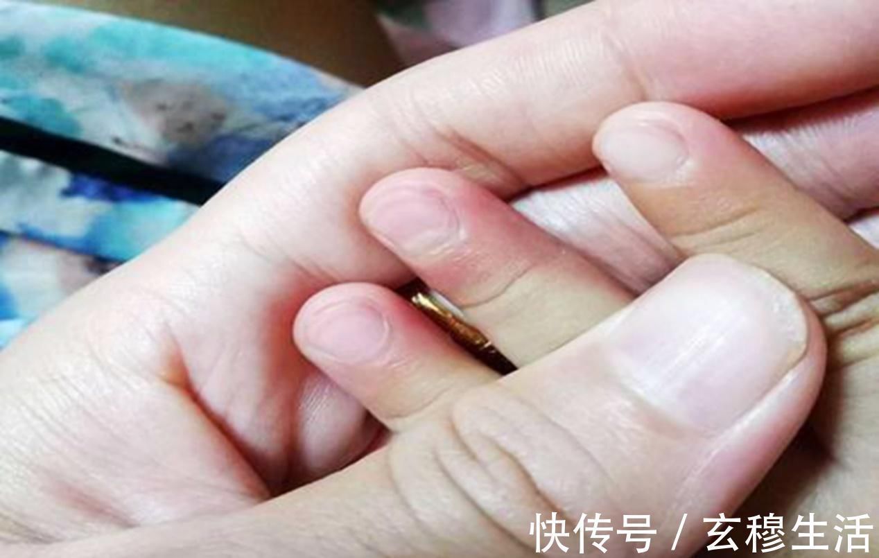 性格|一咬指甲就咬到“秃”的孩子,长大不仅影响性格,还影响身体健康