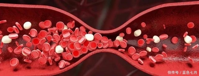 为什么会得糖尿病?权威学会公布8大趋势,快来刷新你的控糖知识