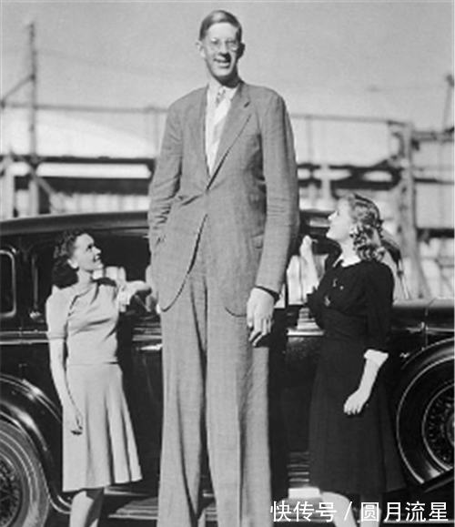 湘雅医学院|印度第一女巨婴:1岁体重45斤,一顿吃2斤米,如今过得怎样