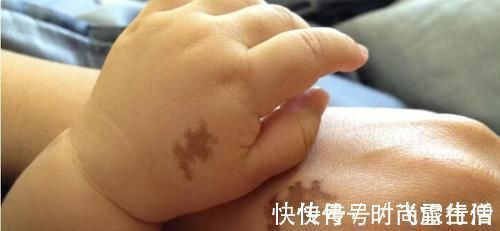 行为|胎记是怎么来的产科医生孕期远离3种行为,避免胎儿长记号