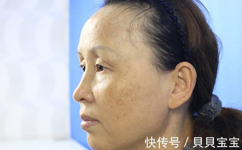 平菇 天然“除皱剂”被找到,医生提醒:坚持常吃2物,或能护肤养气色