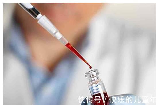 检查|唐氏儿最易找上两种宝妈,做好3种检查,帮孕妇避开唐氏风险