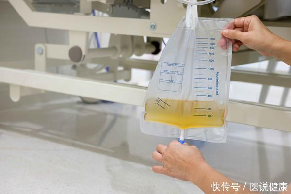 食欲不振|莫名出现6个迹象,或是肾脏病变的求救信号,需重视