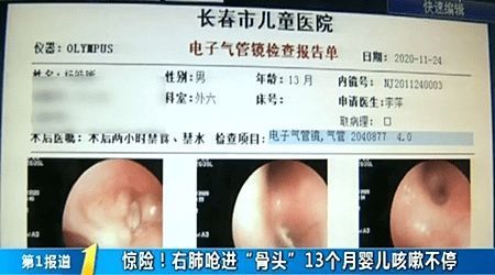 父母|13个月大婴儿为啥一直咳嗽?检查后为啥父母吓傻了?