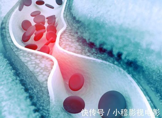 高血压患者|2021“新血压标准”或已公布,不再是120/80mmHg,你达标了吗?