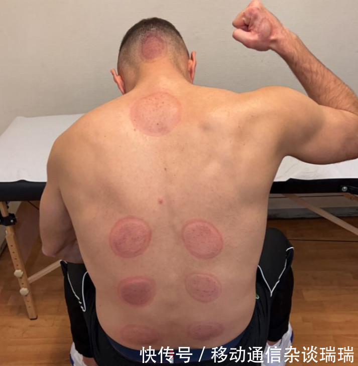 佩雷斯|停不下来!34岁皇马巨星沉迷拔罐,1年狂轰30+11,力压梅西登顶