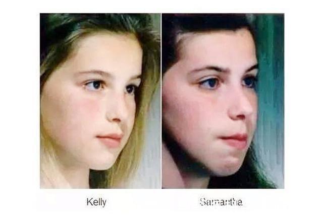 鼻炎|鼻炎有多难治，会影响正常生活吗？