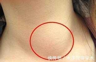 人体健康|白萝卜营养价值高,但不宜与这几种食物搭配食用,建议收藏哦