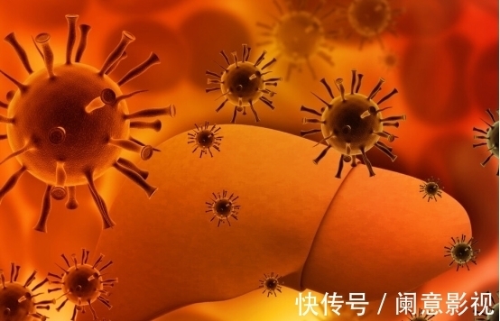 口干|肝癌初期“无声无息”?晨起发现3个“异常”,建议你早做检查