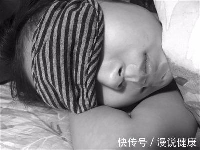 治疗|孩子睡觉总是张口呼吸,难道睡得香?告知家长,或许是这种病引起