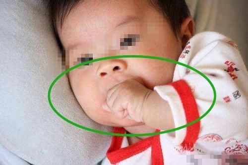 医院|半岁男婴总紧握拳头,奶奶感觉不对后立刻送去医院,医生:来晚了